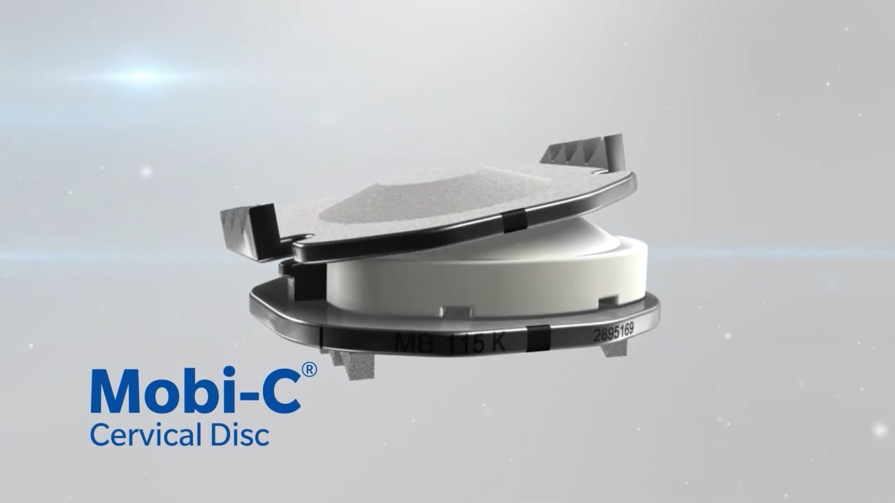 Still frame from the Mobi-C animation comparing cervical disc replacement to fusion